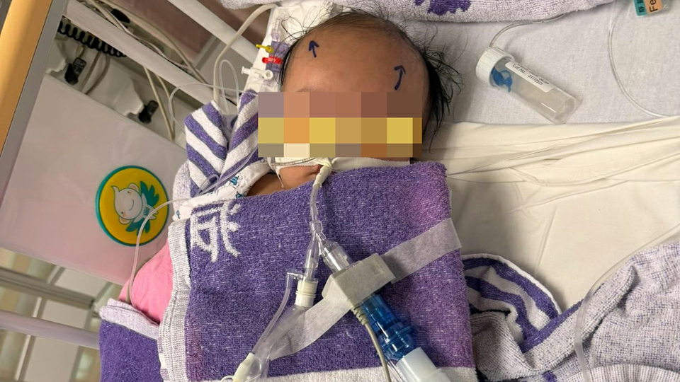 4月大男嬰疑被虐待致腦出血失去知覺 警拘2名外傭
