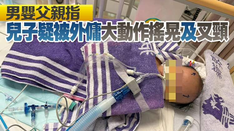 4月大男嬰疑被虐待致腦出血失去知覺 警拘2名外傭
