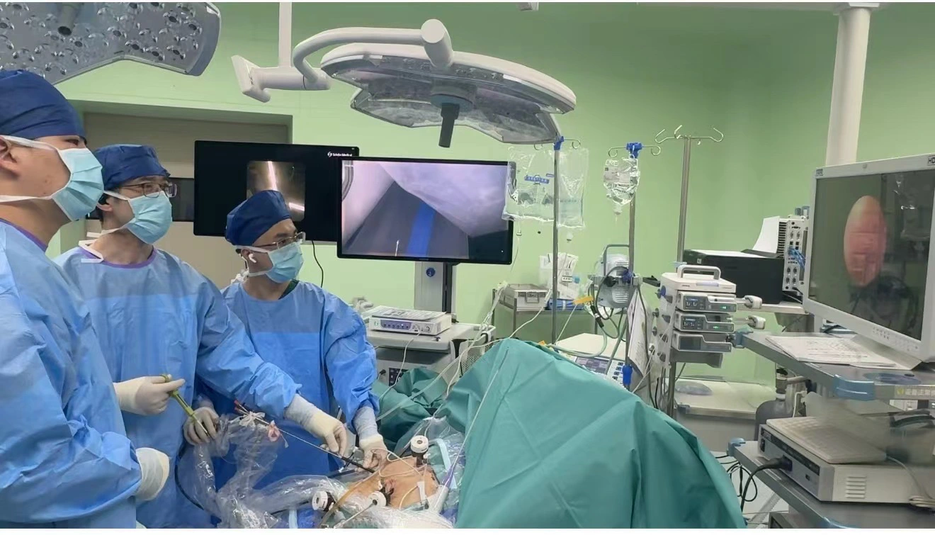 超細膽道硬鏡微創技術 破解複雜肝內膽管結石難題