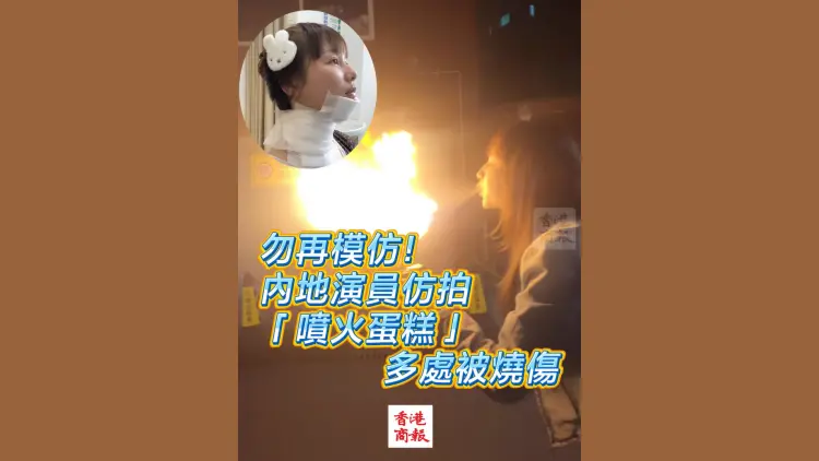 有片丨勿模仿！內地演員仿拍「噴火蛋糕」 多處被燒傷