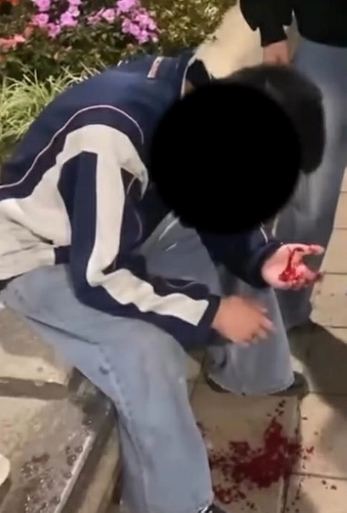 天水圍23歲男遭圍毆 兩男涉傷人落網