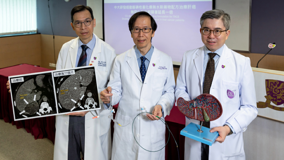 中大研發經動脈碘栓塞化療無水新藥物配方治療肝細胞化