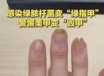 有片｜鍾意做美甲的小姐妹注意啦，警惕美甲變「毀甲」！