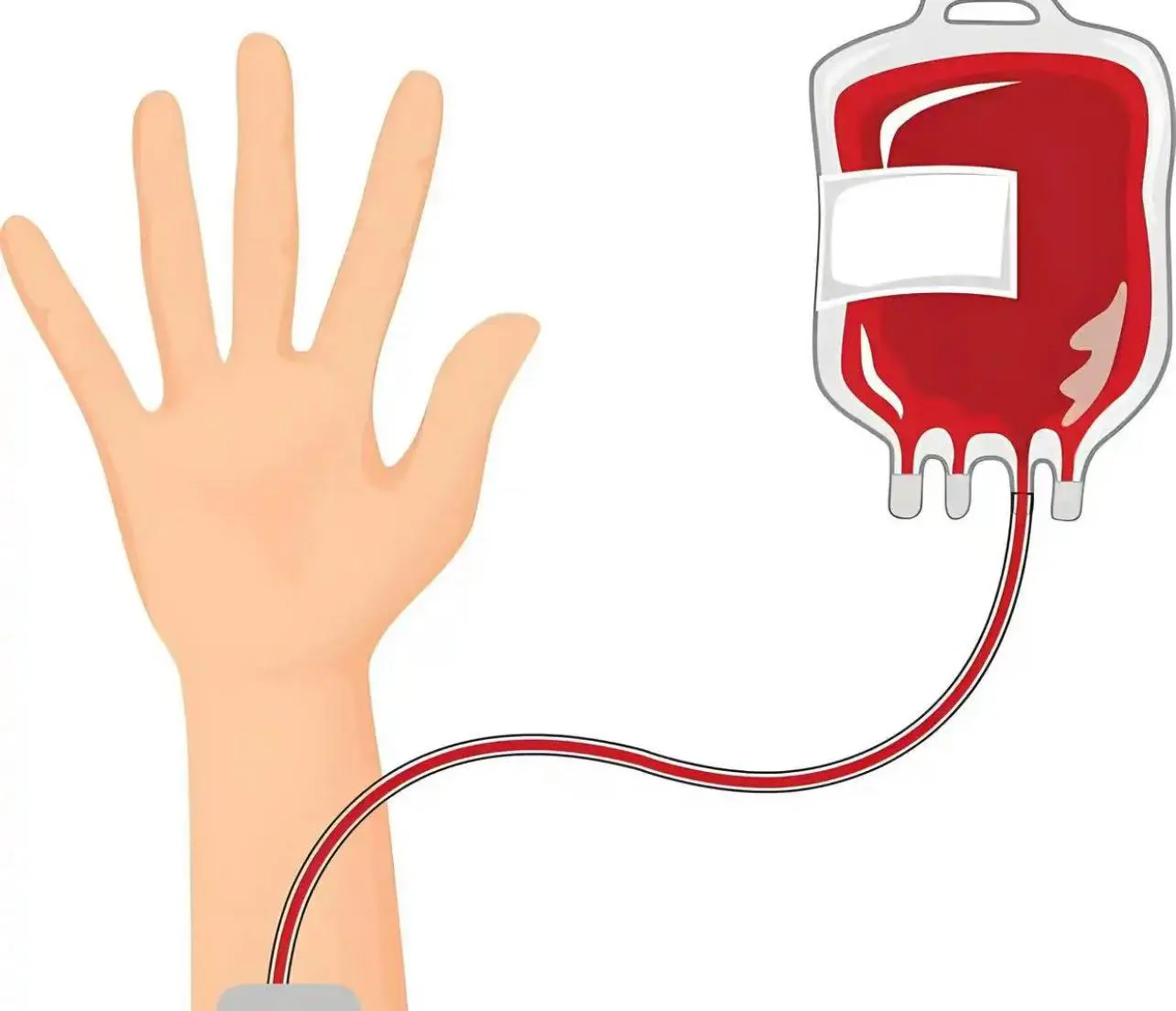 有片｜歌手鄧紫棋自曝患地中海貧血，醫生：千萬別盲目補鐵！ 