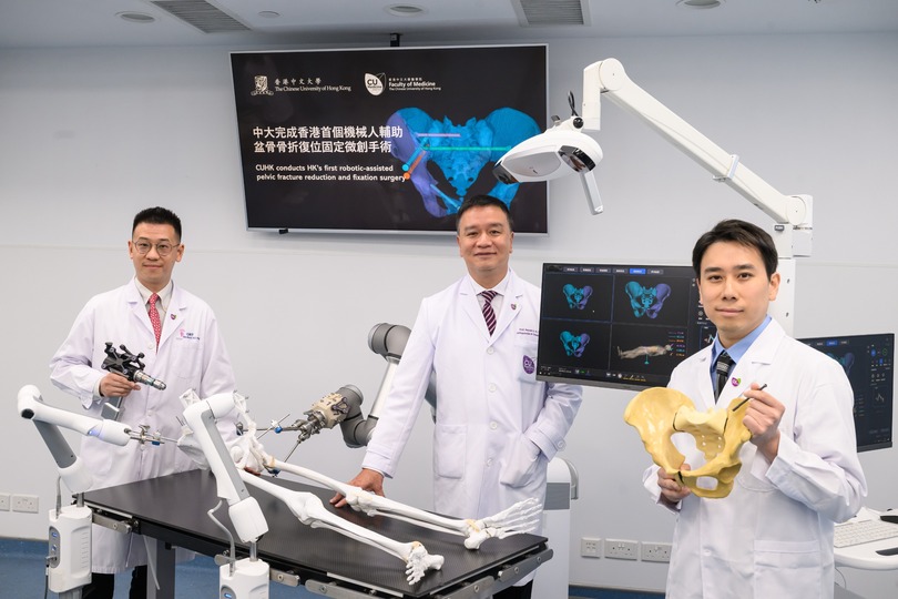 中大完成香港首例機械人輔助盆骨骨折復位 固定微創手術開創創傷骨科治療新里程 